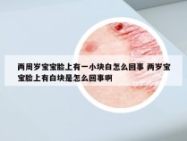 两周岁宝宝脸上有一小块白怎么回事 两岁宝宝脸上有白块是怎么回事啊