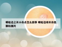 眼睑边上长小白点怎么回事 眼睑边缘长白色颗粒图片