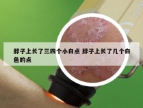 脖子上长了三四个小白点 脖子上长了几个白色的点