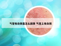 气管有白斑是怎么回事 气管上有白斑