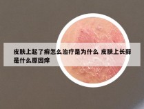 皮肤上起了癣怎么治疗是为什么 皮肤上长藓是什么原因痒