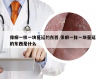 像癣一样一块蔓延的东西 像癣一样一块蔓延的东西是什么