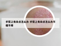 手臂上有白点怎么办 手臂上有白点怎么办不痛不痒