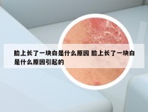 脸上长了一块白是什么原因 脸上长了一块白是什么原因引起的