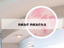 奶癣治疗 奶癣治疗办法