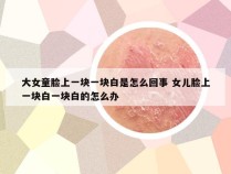 大女童脸上一块一块白是怎么回事 女儿脸上一块白一块白的怎么办