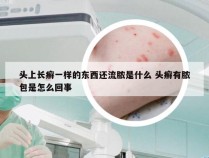 头上长癣一样的东西还流脓是什么 头癣有脓包是怎么回事