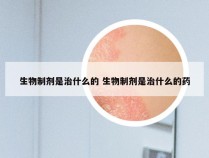 生物制剂是治什么的 生物制剂是治什么的药