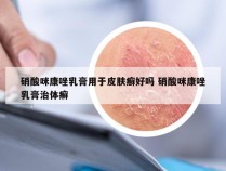 硝酸咪康唑乳膏用于皮肤癣好吗 硝酸咪康唑乳膏治体癣