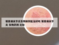 银屑病关节炎生物制剂能治好吗 银屑病关节炎 生物药剂 比较