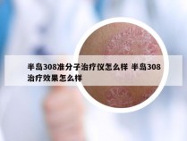 半岛308准分子治疗仪怎么样 半岛308治疗效果怎么样