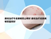 廊坊治疗牛皮癣哪家口碑好 廊坊治疗皮肤病哪家医院好