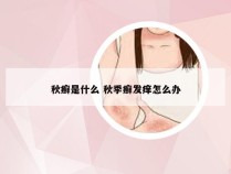 秋癣是什么 秋季癣发痒怎么办