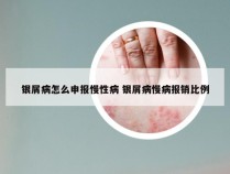 银屑病怎么申报慢性病 银屑病慢病报销比例