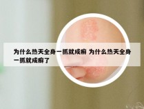 为什么热天全身一抓就成癣 为什么热天全身一抓就成癣了