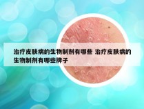 治疗皮肤病的生物制剂有哪些 治疗皮肤病的生物制剂有哪些牌子