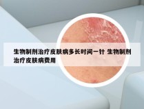 生物制剂治疗皮肤病多长时间一针 生物制剂治疗皮肤病费用