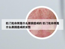 肛门处白斑是什么原因造成的 肛门处白斑是什么原因造成的女性