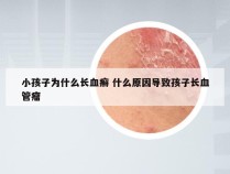 小孩子为什么长血癣 什么原因导致孩子长血管瘤