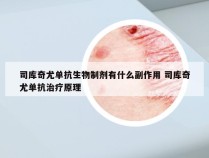 司库奇尤单抗生物制剂有什么副作用 司库奇尤单抗治疗原理