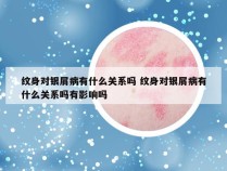 纹身对银屑病有什么关系吗 纹身对银屑病有什么关系吗有影响吗