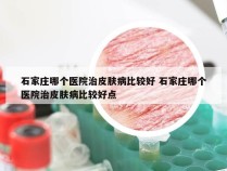 石家庄哪个医院治皮肤病比较好 石家庄哪个医院治皮肤病比较好点