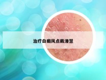 治疗白癜风点戴溱慧