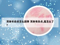 浑身长白点怎么回事 浑身有白点,是怎么了?