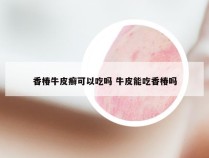 香椿牛皮癣可以吃吗 牛皮能吃香椿吗