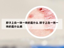 脖子上白一块一块的是什么 脖子上白一块一块的是什么病