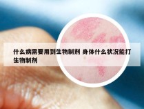 什么病需要用到生物制剂 身体什么状况能打生物制剂