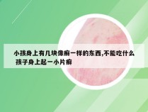 小孩身上有几块像癣一样的东西,不能吃什么 孩子身上起一小片癣