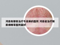 河南有那些治疗牛皮癣的医院 河南省治疗银屑病哪家医院最好