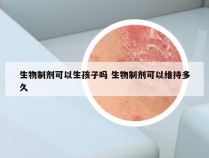 生物制剂可以生孩子吗 生物制剂可以维持多久