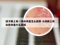 孩子脚上有一块白块是怎么回事 小孩脚上有白色块是什么原因