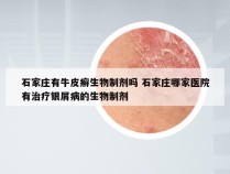 石家庄有牛皮癣生物制剂吗 石家庄哪家医院有治疗银屑病的生物制剂