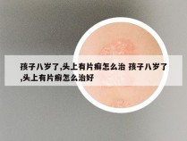 孩子八岁了,头上有片癣怎么治 孩子八岁了,头上有片癣怎么治好