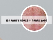 得白殿疯用不用休班治疗 白殿疯能治好吗