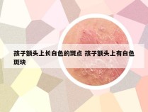 孩子额头上长白色的斑点 孩子额头上有白色斑块