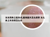 女女孩身上起白点,越来越大怎么回事 女儿身上长白斑怎么办