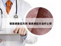 银屑病善后方剂 银屑病经方治疗心得