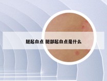 腿起白点 腿部起白点是什么