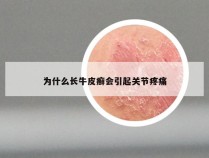 为什么长牛皮癣会引起关节疼痛