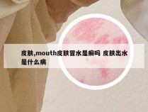 皮肤,mouth皮肤冒水是癣吗 皮肤出水是什么病