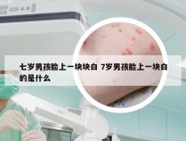 七岁男孩脸上一块块白 7岁男孩脸上一块白的是什么