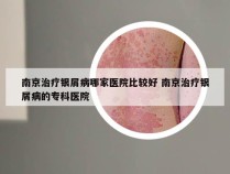 南京治疗银屑病哪家医院比较好 南京治疗银屑病的专科医院