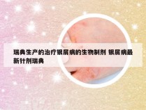 瑞典生产的治疗银屑病的生物制剂 银屑病最新针剂瑞典