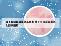 腋下有块白斑是怎么回事 腋下有块白斑是怎么回事图片