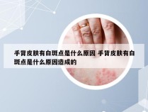 手背皮肤有白斑点是什么原因 手背皮肤有白斑点是什么原因造成的