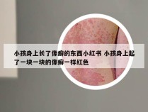 小孩身上长了像癣的东西小红书 小孩身上起了一块一块的像癣一样红色